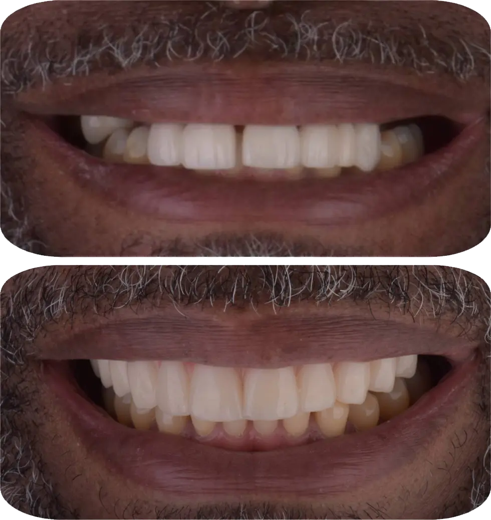 Before After Image 1