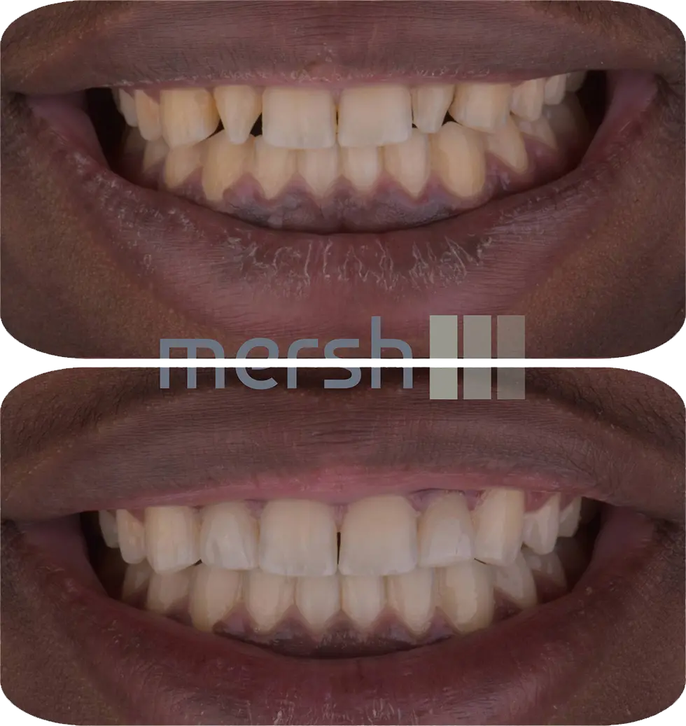 Before After Image 7