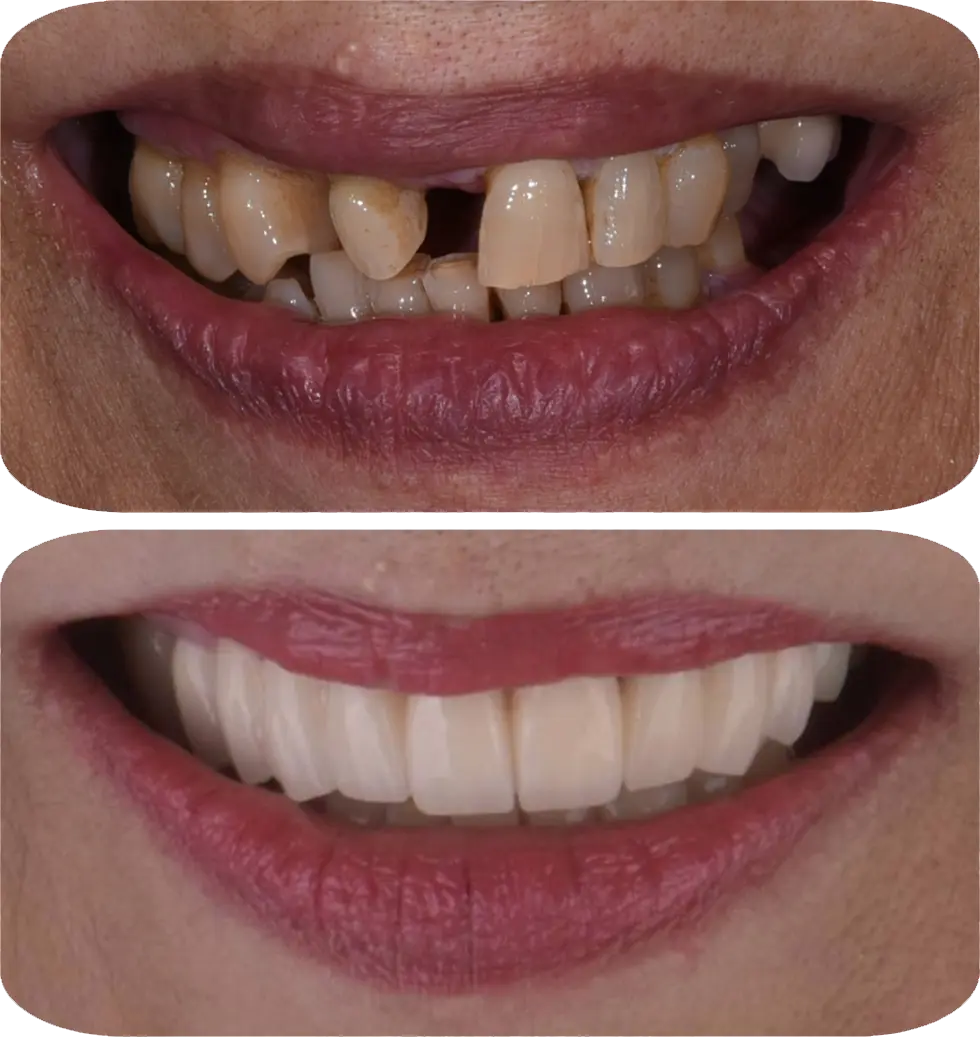 Lumiere Cosmetic and Implant Dentistry | Google Ads Image 2