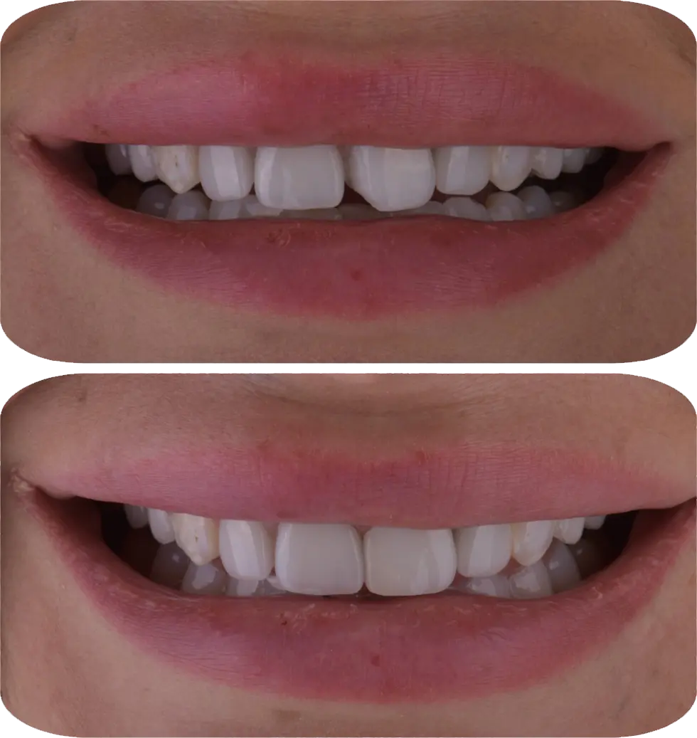Lumiere Cosmetic and Implant Dentistry | Google Ads Image 3