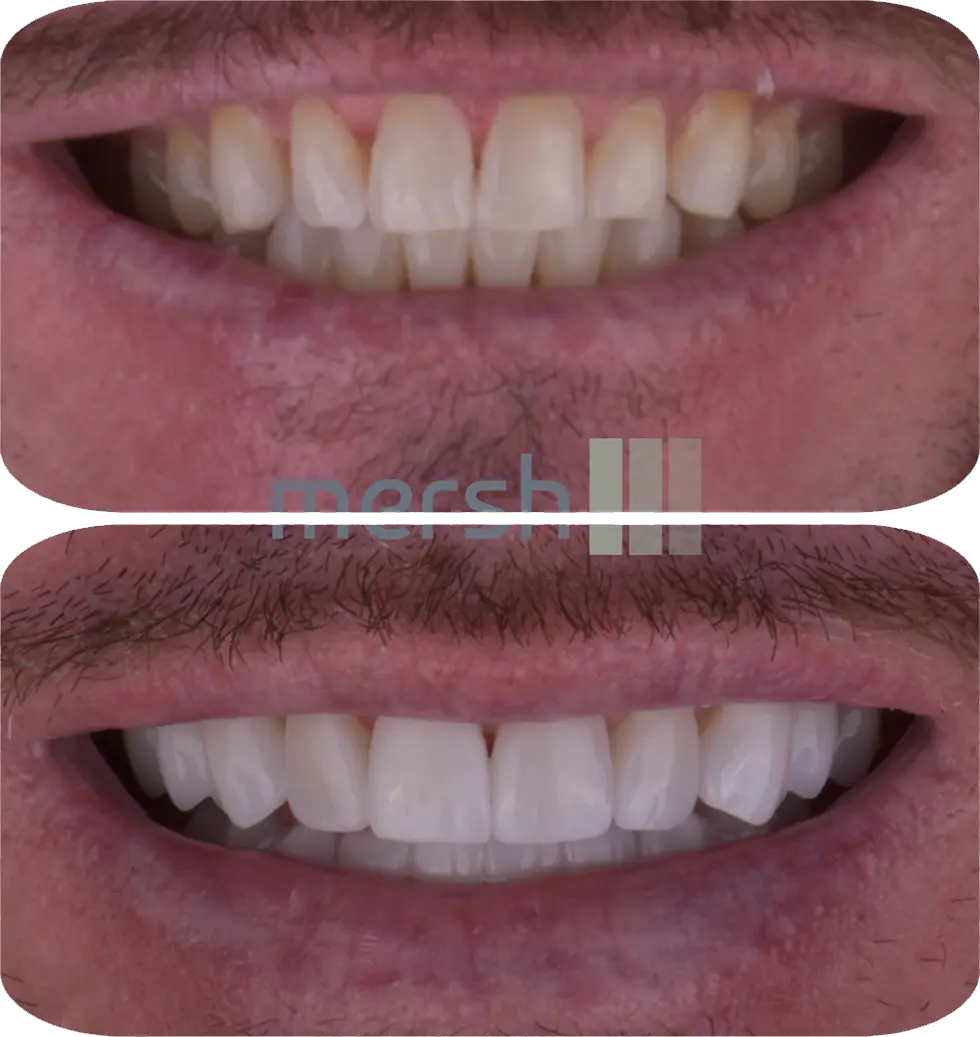 Lumiere Cosmetic and Implant Dentistry | Google Ads Image 4