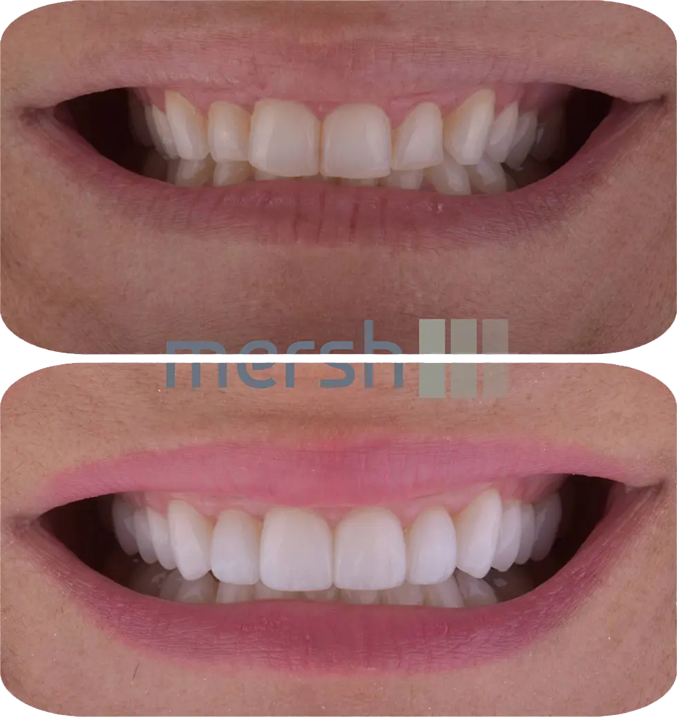 Lumiere Cosmetic and Implant Dentistry | Google Ads Image 4