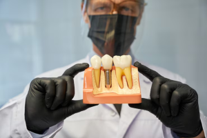 Lumiere Cosmetic and Implant Dentistry | Full Mouth Dental Implants in Maitland: A Life-Changing Option Full Mouth Dental Implants in Maitland