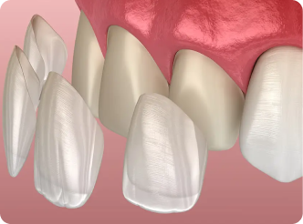 Lumiere Cosmetic and Implant Dentistry | Homepage