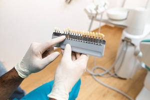 Lumiere Cosmetic and Implant Dentistry | What Are Porcelain Veneers and How Can They Transform Your Smile?