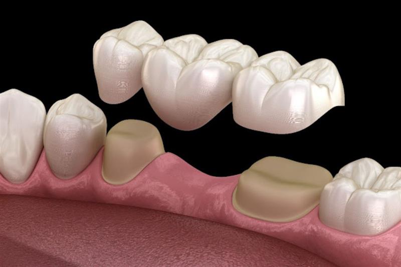 Lumiere Cosmetic and Implant Dentistry | Homepage