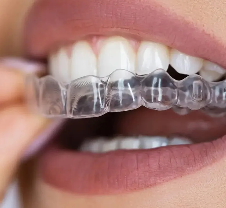 Lumiere Cosmetic and Implant Dentistry | Homepage