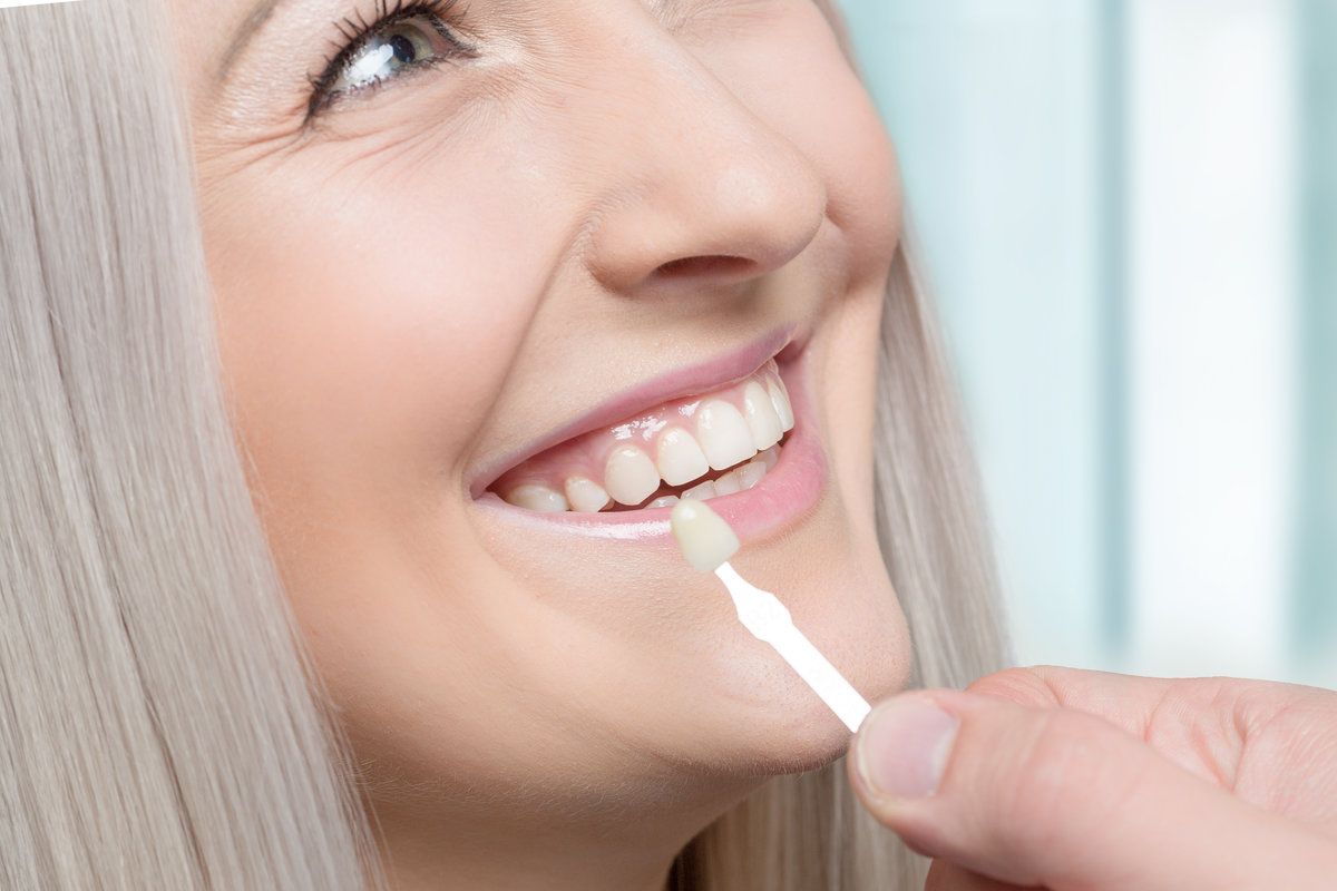 Woman smiling while putting her veneers